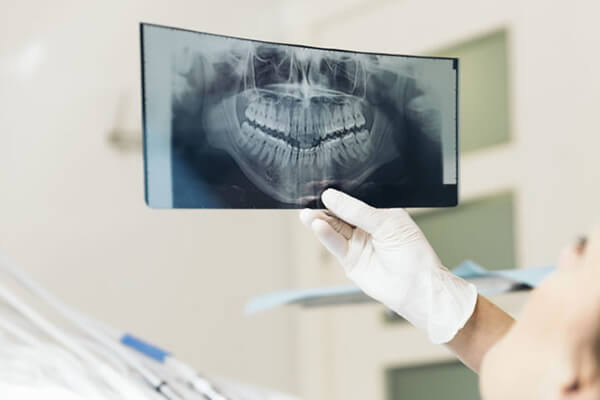 dental x-ray

